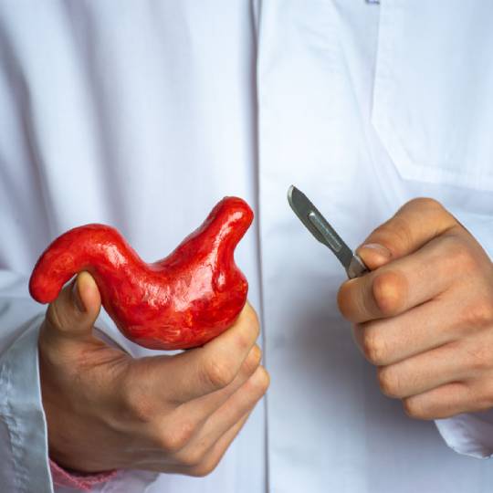 https://essemedicare.de/wp-content/uploads/2023/02/gastric_sleeve_3.jpg